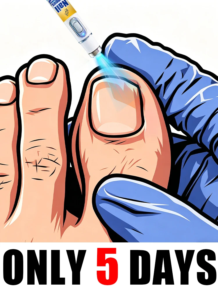 

2026 New Portable Blue Light Laser Pen for Foot Home Use Suitable for Both Men and Women