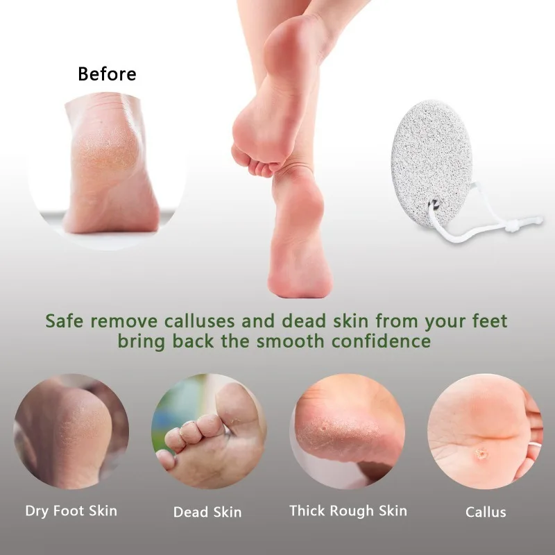 火山性軽石フットスクラバー - 角質やひび割れたかかとの除去のための天然角質除去石、滑らかな足のための楕円形研磨ツール