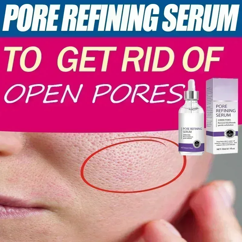 การขจัดรูขุมขนขนาดใหญ่บนใบหน้า Pore Rinning Resurfacing เซรั่มหดตัวรูขุมขนอันทรงพลังเพื่อการกระชับ