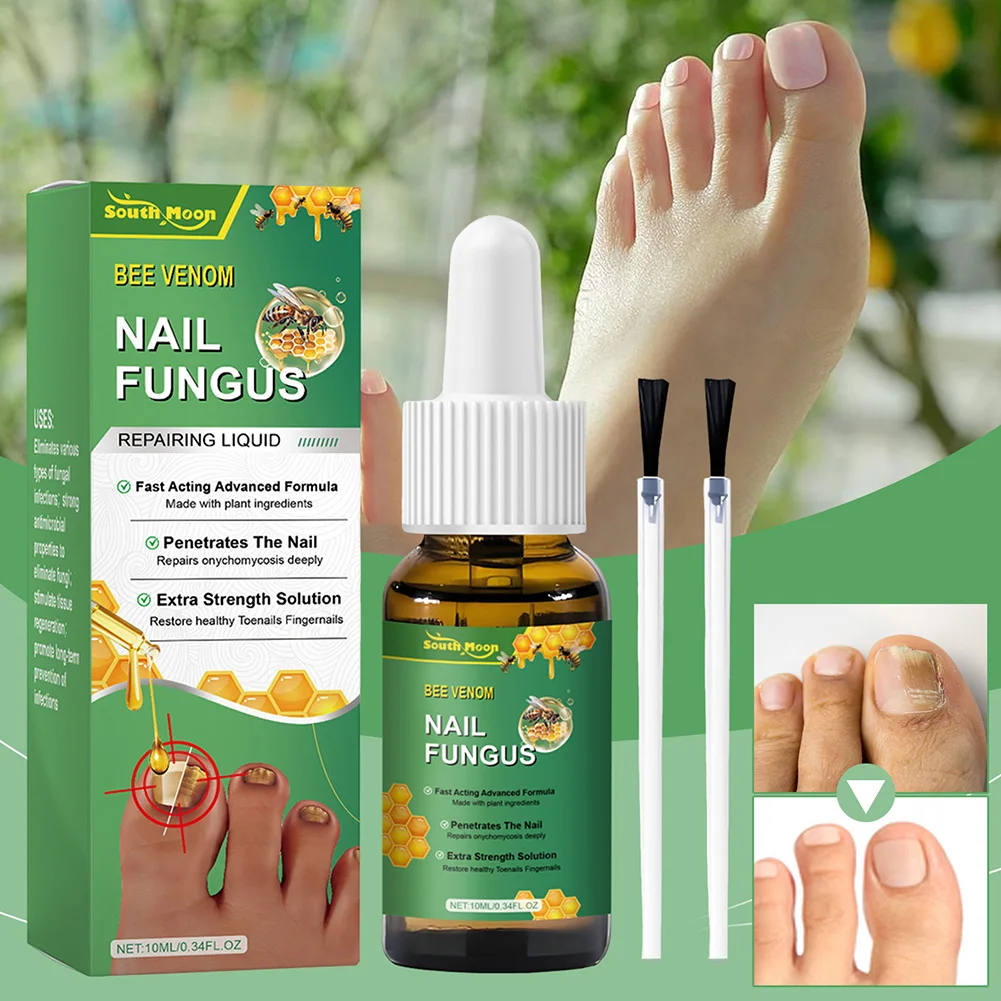 Bee-venom Nail-Fungals Soothing Spray Hand Foot Nail Treatments Serum Anti Infection Treatment Paronychia Strengthening Liquid