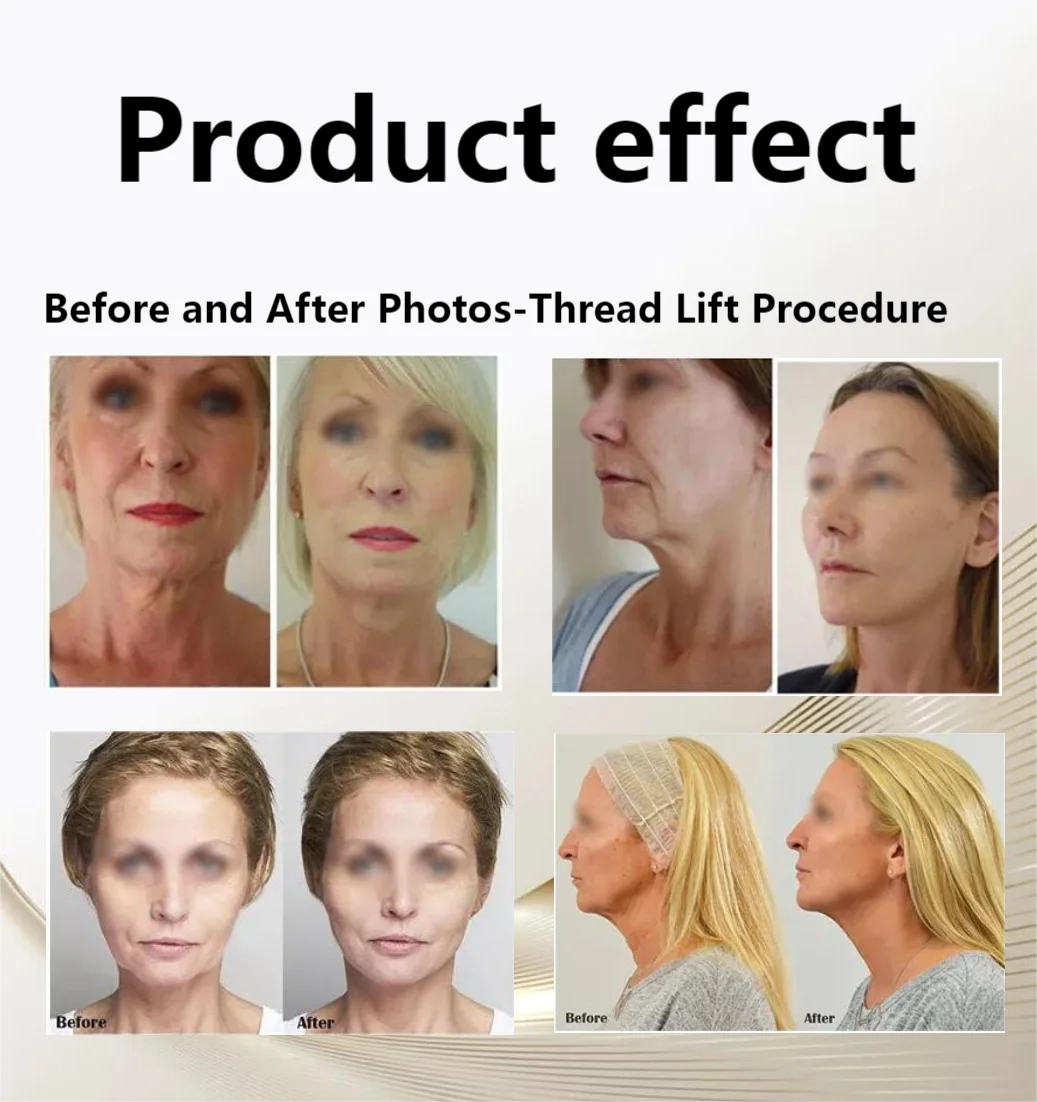 Protein Lifting Line Anti Wrinkle V Face Lifting Slimming Facial Skin Tightening Facial Contour Lightening Fine Lines Moistening