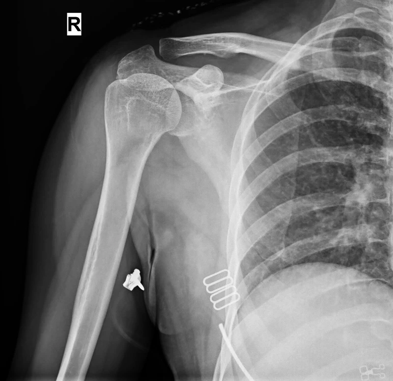 DR Przewodowy 17-x17-calowy FPD X Ray / Radiografia wielkości kasetowej Cyfrowy wykrywacz płaskich paneli FPD