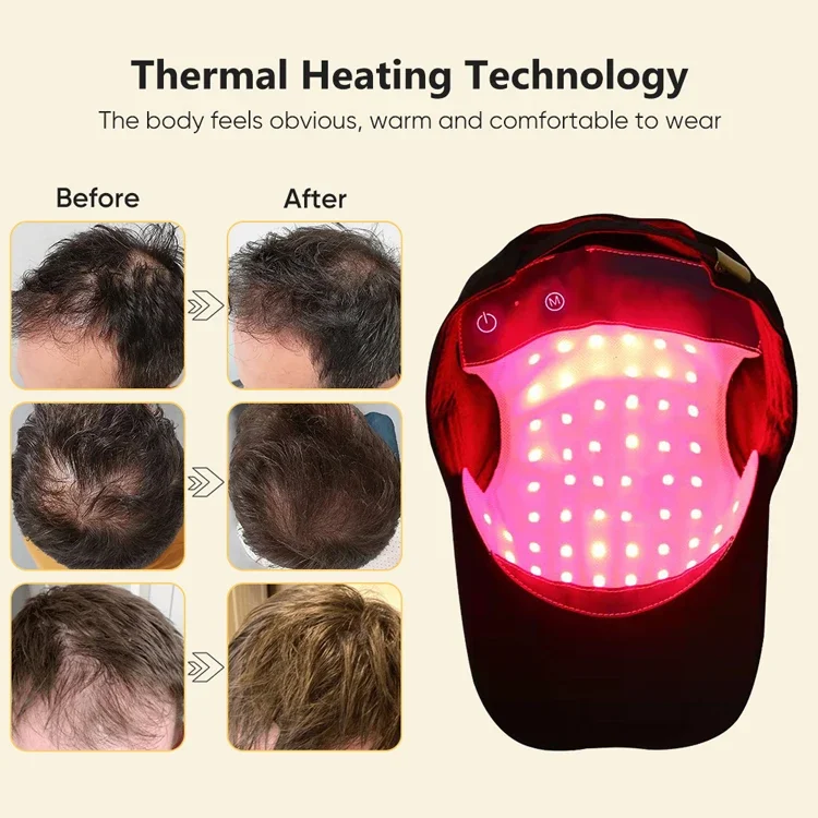 450nm 660nm 810nm Wireless Red Light Hair Regrowth Cap Low Level Laser Therapy Hair Loss Cap