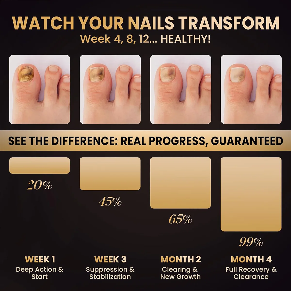 علاج فطريات أظافر القدم، قلم إصلاح أظافر فطرية قوي، علاجات فطريات أظافر القدم، غسول آمن لإصلاح الأظافر للرجال والأظافر