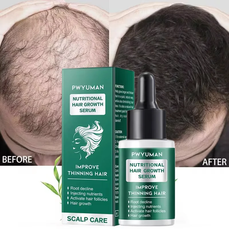 

7 Days Fast Hair Growth Serum Prevent Hair Loss Hair Regrowth Essential Oil Repair Damaged Hair Roots Hair Care For Women Men