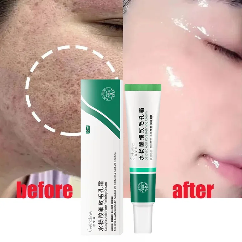 Salicylic Acid Pore Shrinking Cream Quick Elimination Large Pores Remove Blackehead Tighten Face Smooth Skin Korean Care Product