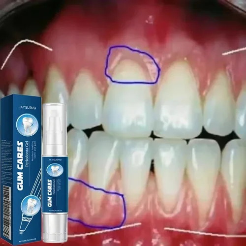 Gel para el cuidado de la reparación de las encías dañadas, alivia la alérgencia de las encías dolorosas, limpieza profunda de las manchas de dientes, suero de sarro, pasta de dientes para caries dentales
