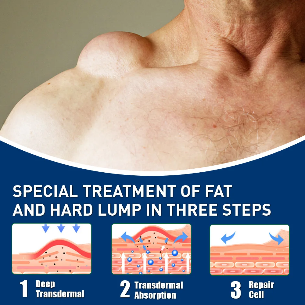 ครีมบำรุงผิวหน้า ฟาตคัง แคร์ ครีมญี่ปุ่น ครีมซ่อมแซมผิวคล้ำ ลดรอยดำ รุ่น K10165