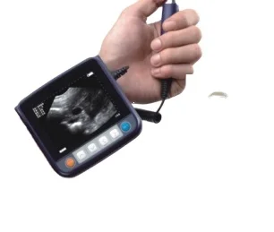 ce approved wrist veterinary ultrasound scanner