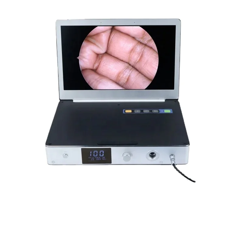 

11.6 Inch Portable Full HD Medical Endoscopy Camera System with Monitor and 30W LED Light Source/ Medical Endoscope Camera