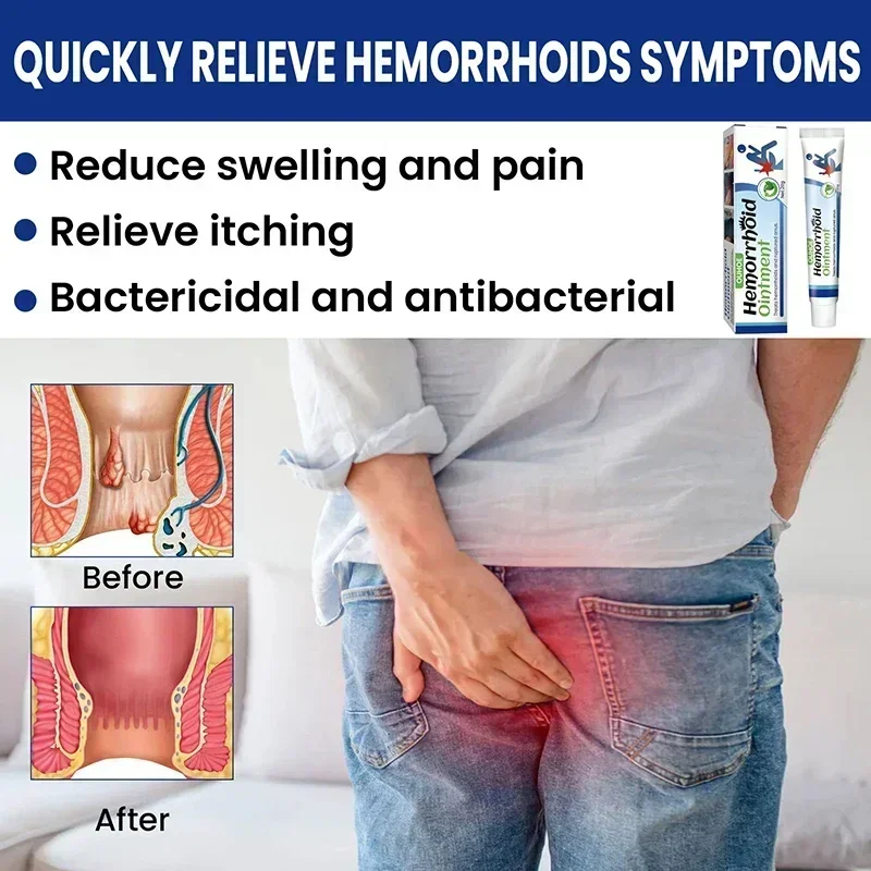 Hemorrhoid Remover Cream Removal Internal Natural Herbal Extract Relieve Anal Anus Swelling Bleeding treatment Gel ointment