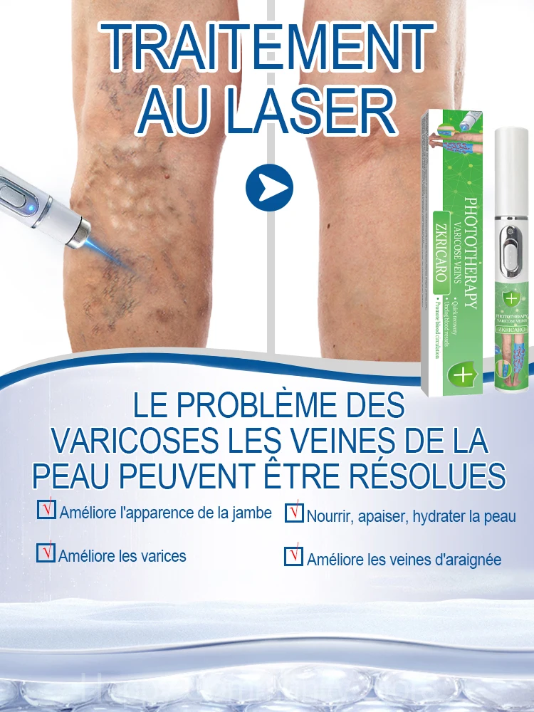 Vente chaude CharacterLaser Leg Vein