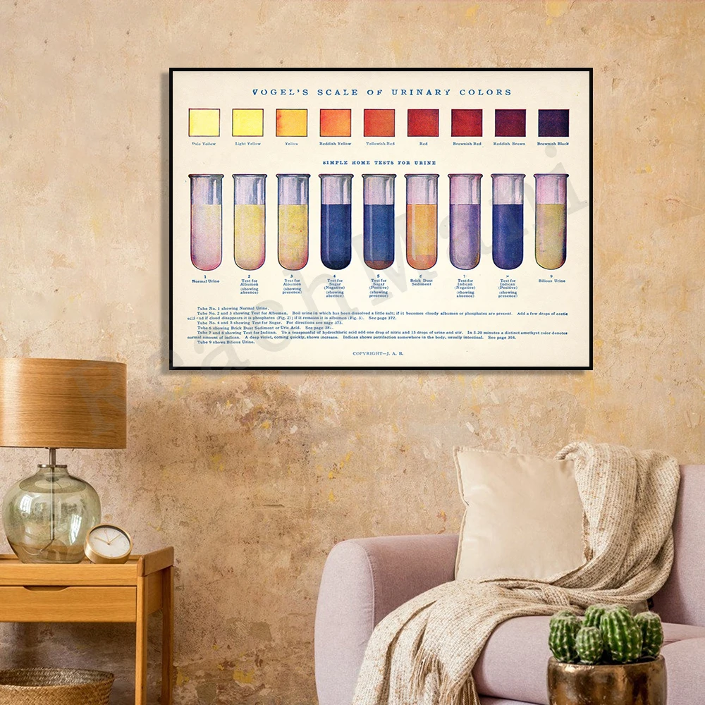 Antique Urine Charts • Unusual Bathroom Art • Vintage Biology Charts • Human Anatomy • Bizarre/weird/weird science posters