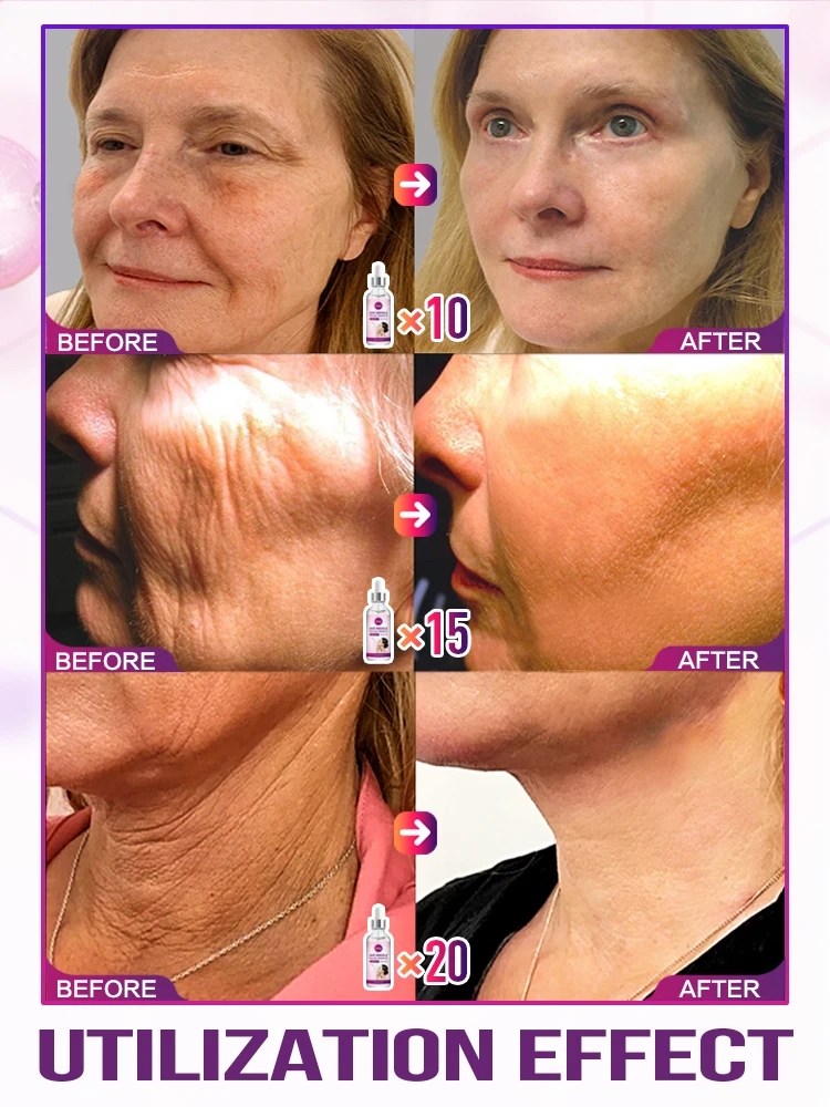 Solve facial aging problems