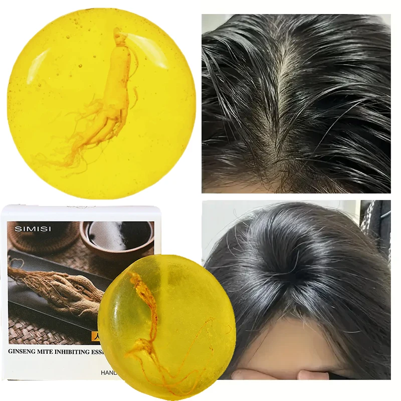 

Ginseng Hair Growth Shampoo Soap Reduce Hair Loss Clean Dandruff Nourish Moisturize Scalp Improve Hair Quality Hair Care Product