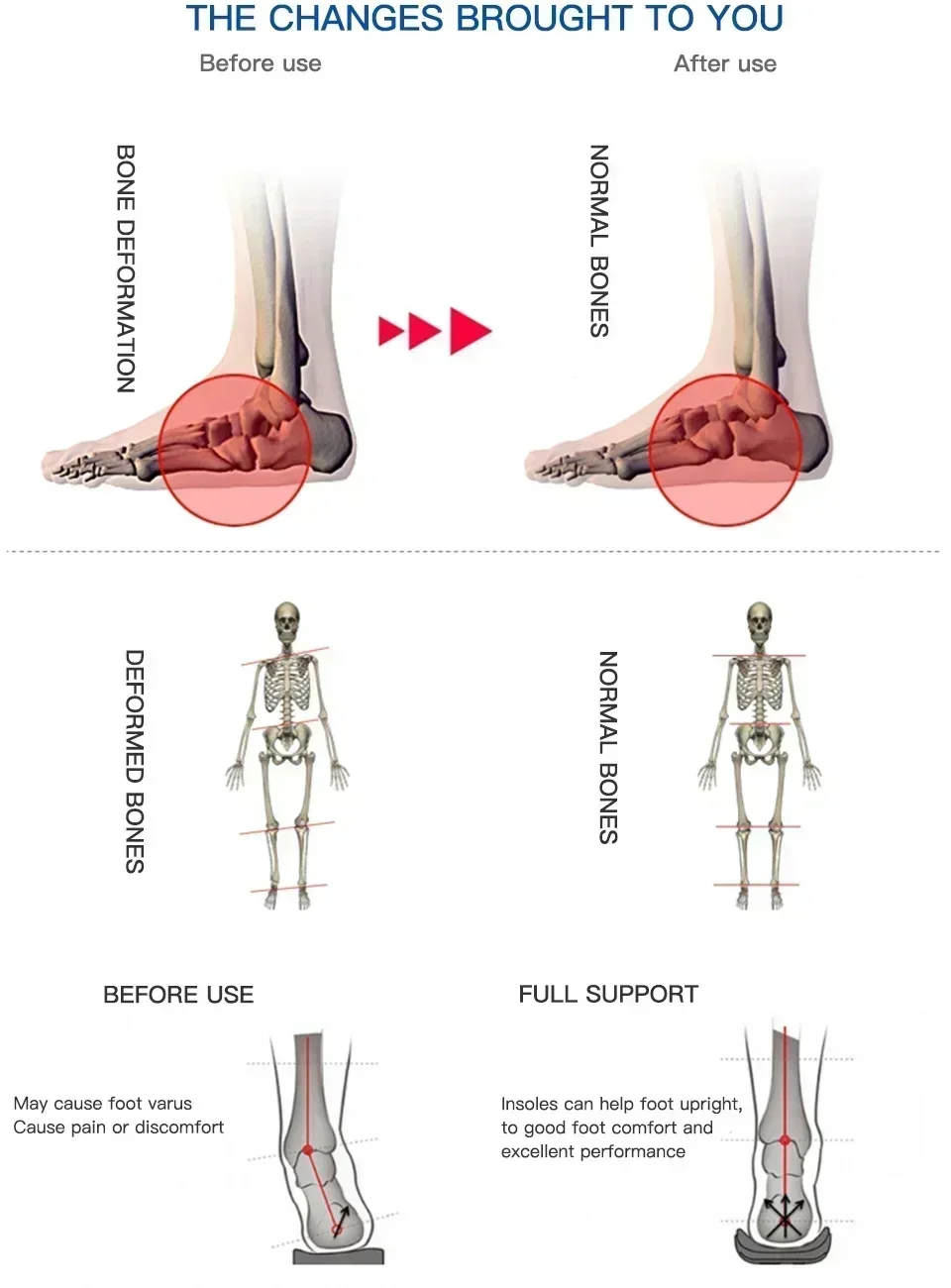 AB Professionelle Einlegesohle zur Fußgewölbeunterstützung für Plattfüße, Schuhkissen, orthopädisches Polster für Fahrrad, Fußball, Laufen, Sport – Detail 6