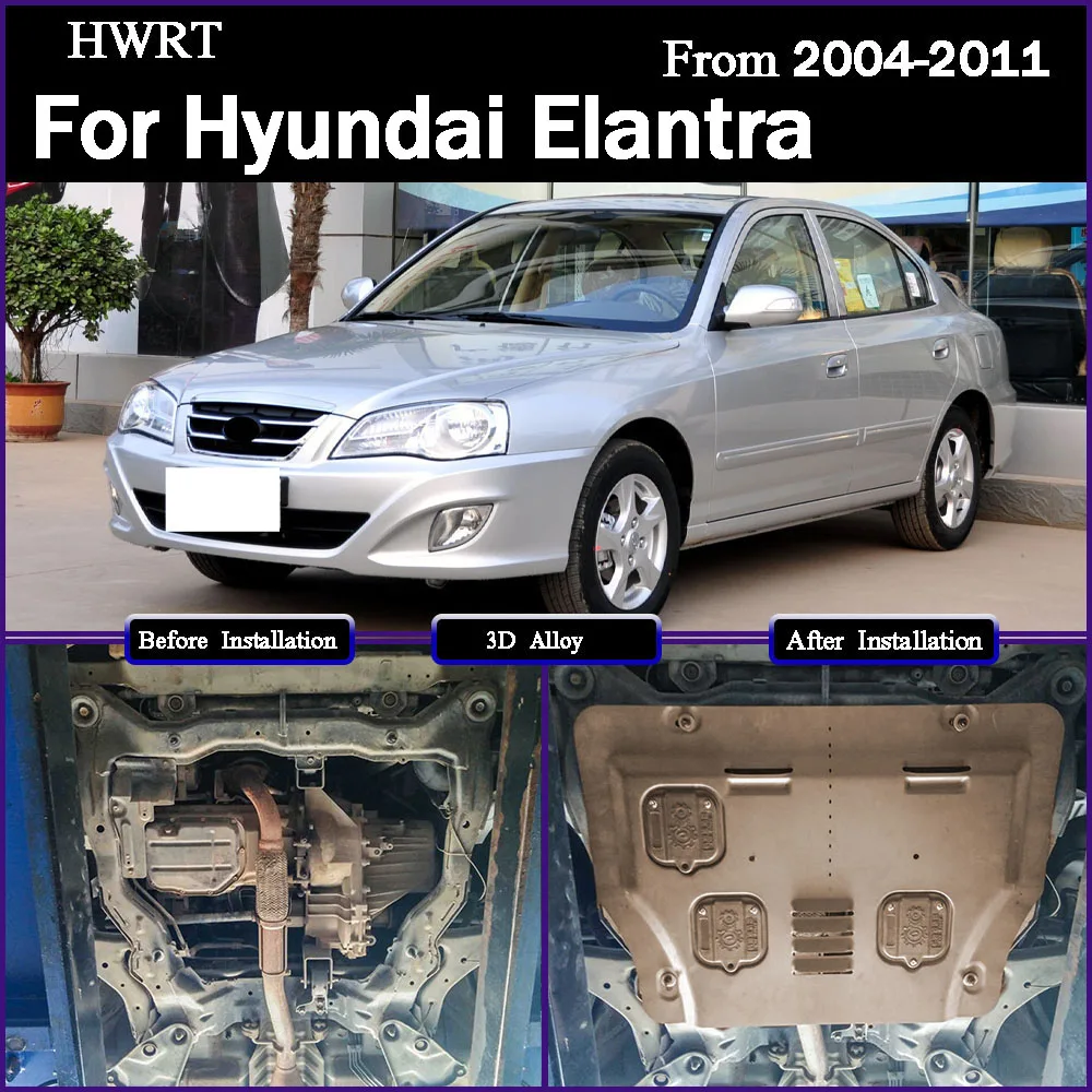 

Car Accessories Black Under Engine Guard Mudguard Board Splash Shield Mud Fender Plate Panel For Hyundai Elantra 2004-2011 1.6L