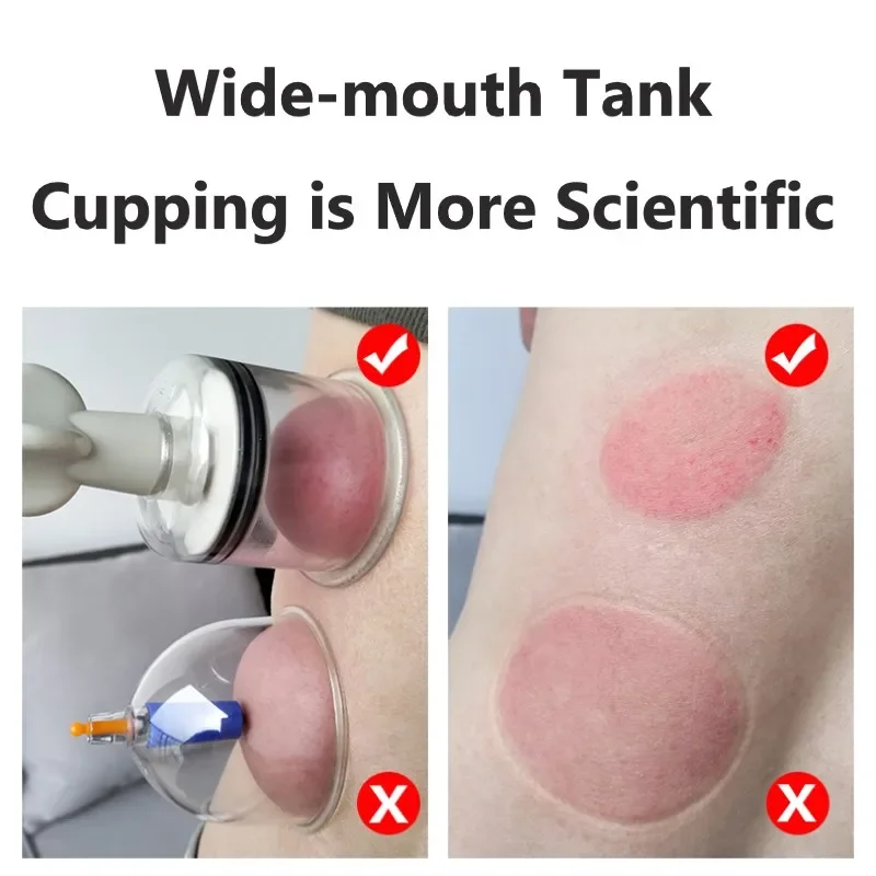 4/8/12 Pcs Cupping Cans Body Massager Vacuum Suction Cups Enhancer Cup Moisture Absorber Anti Cellulite Fat Burner Skin Lifting