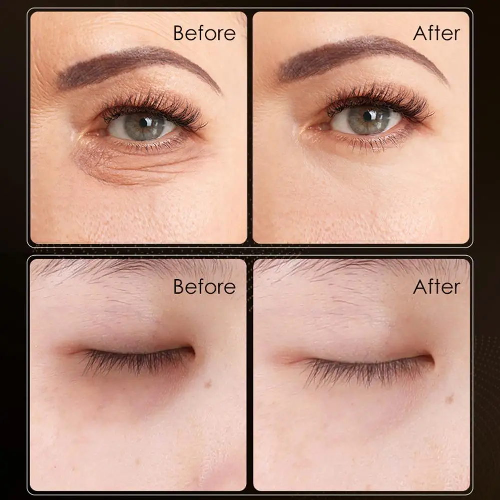 Hot Eyes Cream Collagen Moisturizing Filling Eye Cream Remove Eye Bags Reduce Eye Wrinkles Cream Eye Care Anti Dark Circle Under