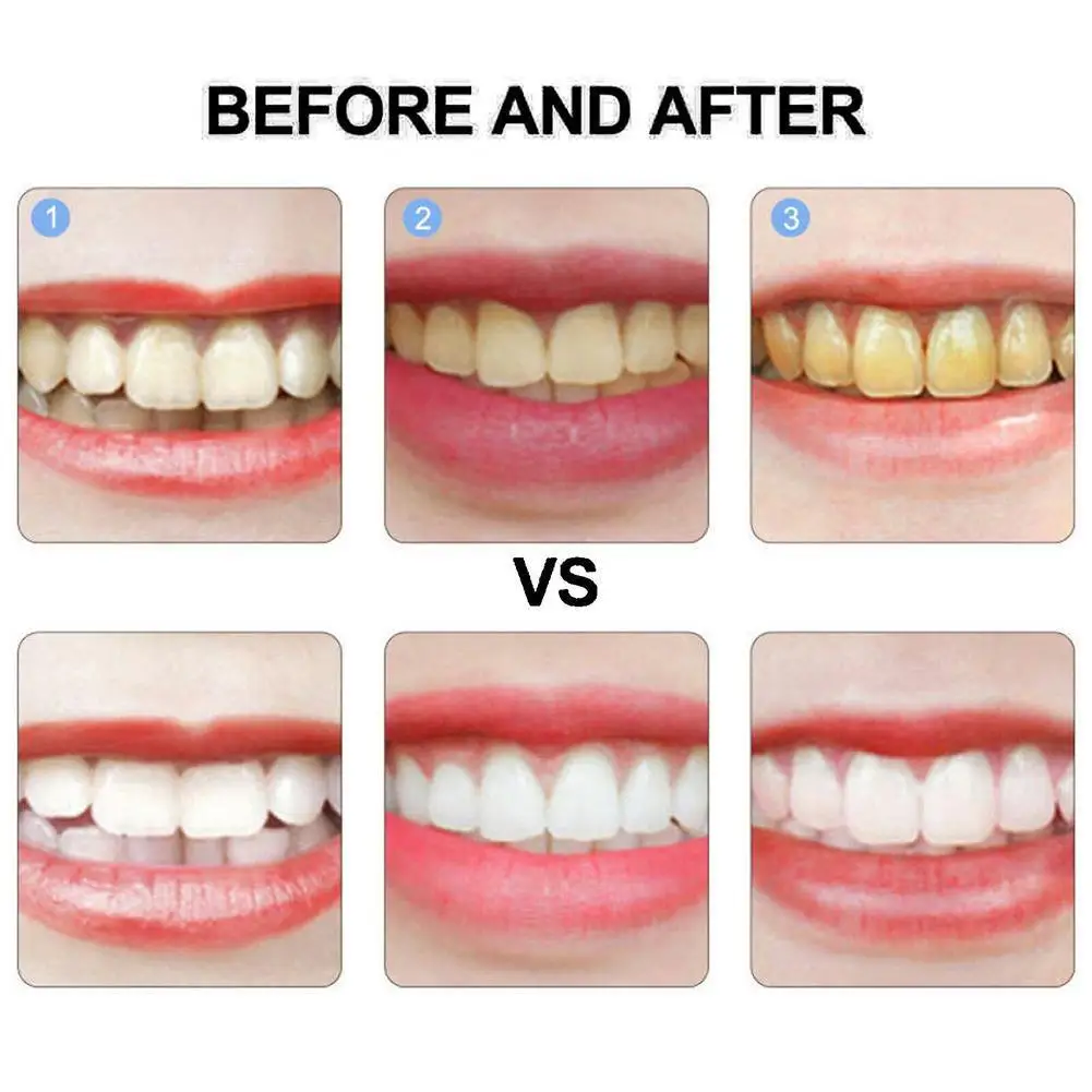 Pasta de dientes para blanquear los dientes, pasta de dientes refrescante para eliminar manchas de probióticos, cuidado de la dentífrico, mejora los dientes orales, SP-4