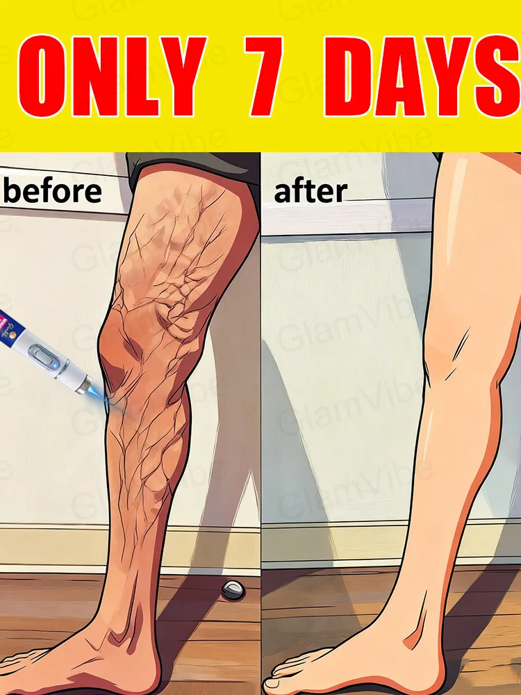 第2世代レーザーで7日で蜘蛛の巣状静脈瘤に別れを告げる