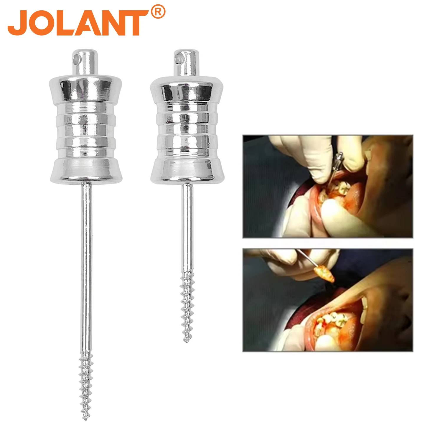 

JOLANT Dental Broken Root Drill Remnant Extractordental Extractor Apical Fragments Medical Stainless Steel Material