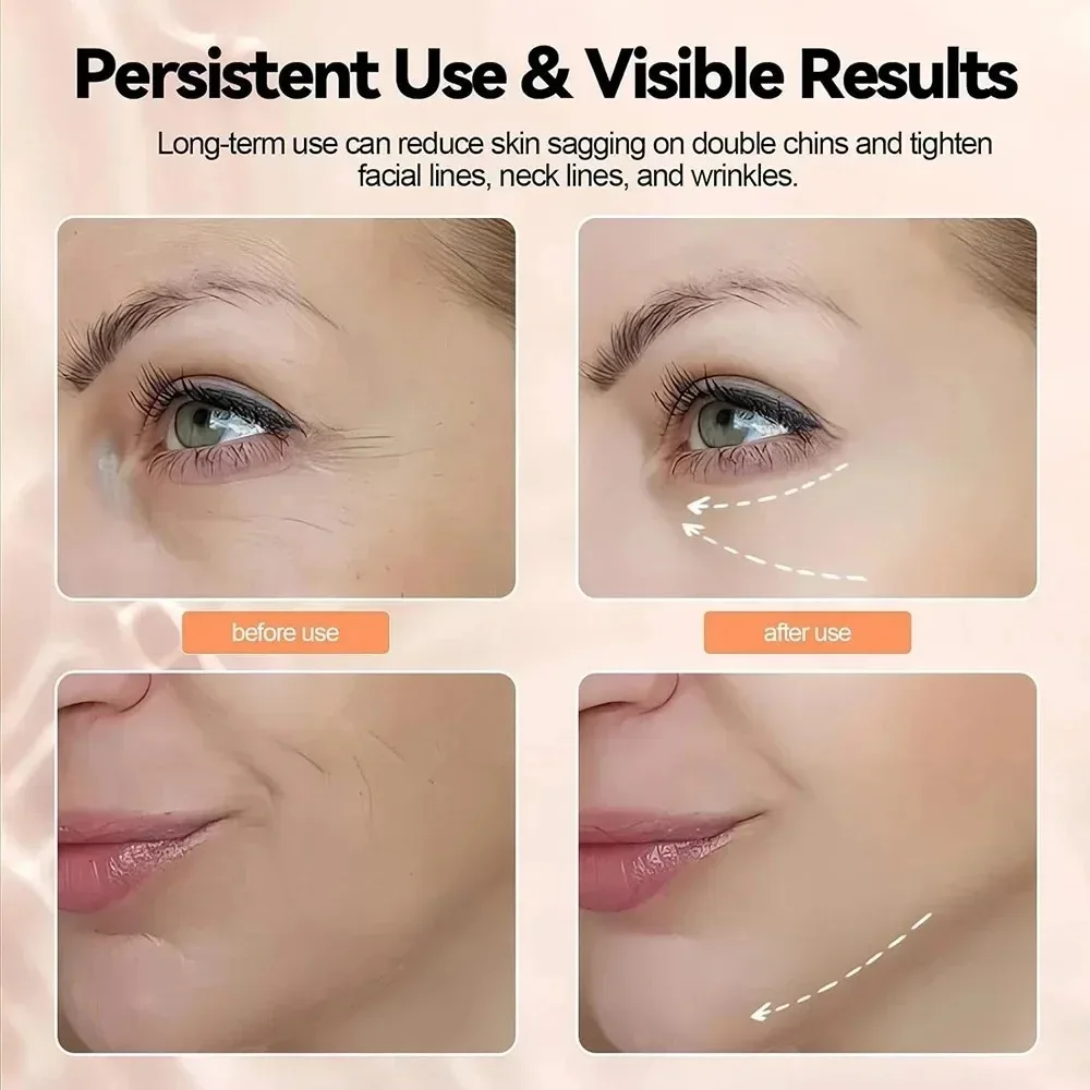 Ems คอ Face Beauty อุปกรณ์เครื่องยกกระชับผิวหน้าผิวกระชับลด Double Chin ต่อต้านริ้วรอยลบ Lifting Skincare Massager