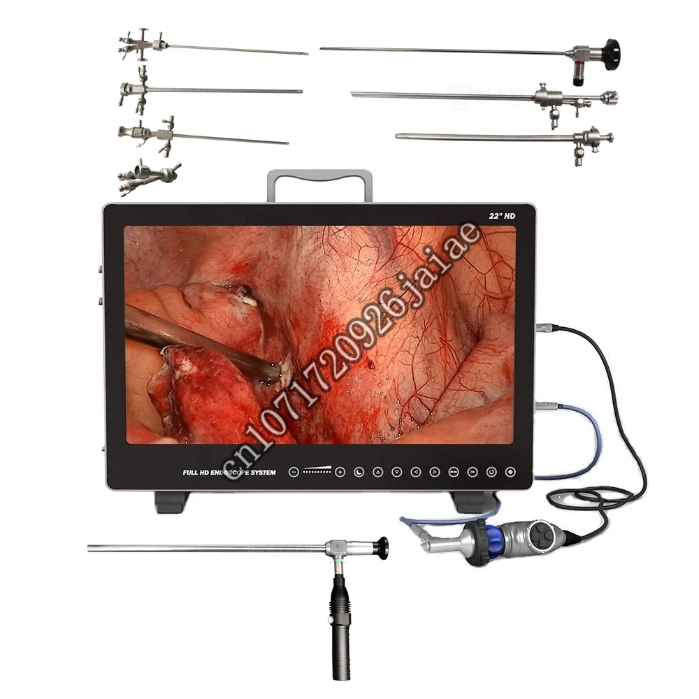 PS050 HD Endoscope  for ENT/Laparoscopy/Hysteroscopy/Urology Portable Endoscopy  Medical Imaging Equipment