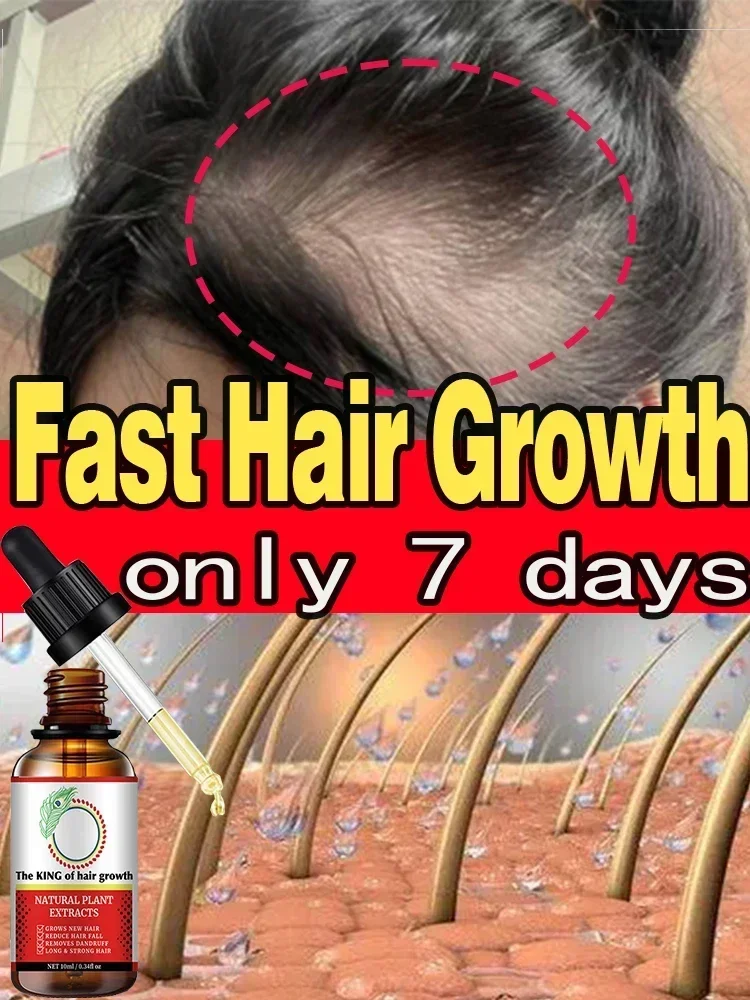 

Fast Hair Growth Oil Baldness Repair Hereditary Hair Loss Postpartum Seborrheic Oil