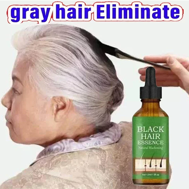 Hot New Anti-grey Hair Essence Serum Treatment Restore Naturalcolor and Restore Healthy White To Black Hair Products Essence 1 0