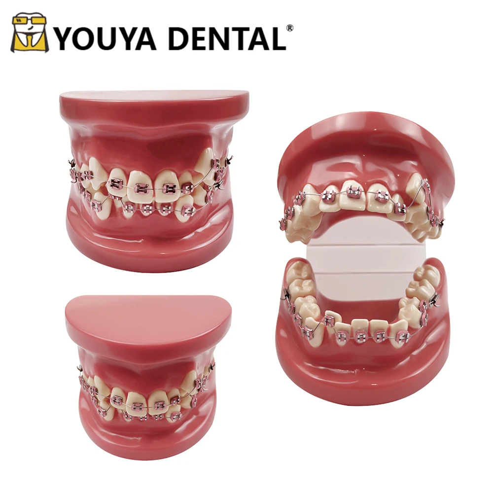 

Dental Orthodontic Teaching Model Teeth Malocclusion Practice Model for Dental Technician Training Study Communication Tool