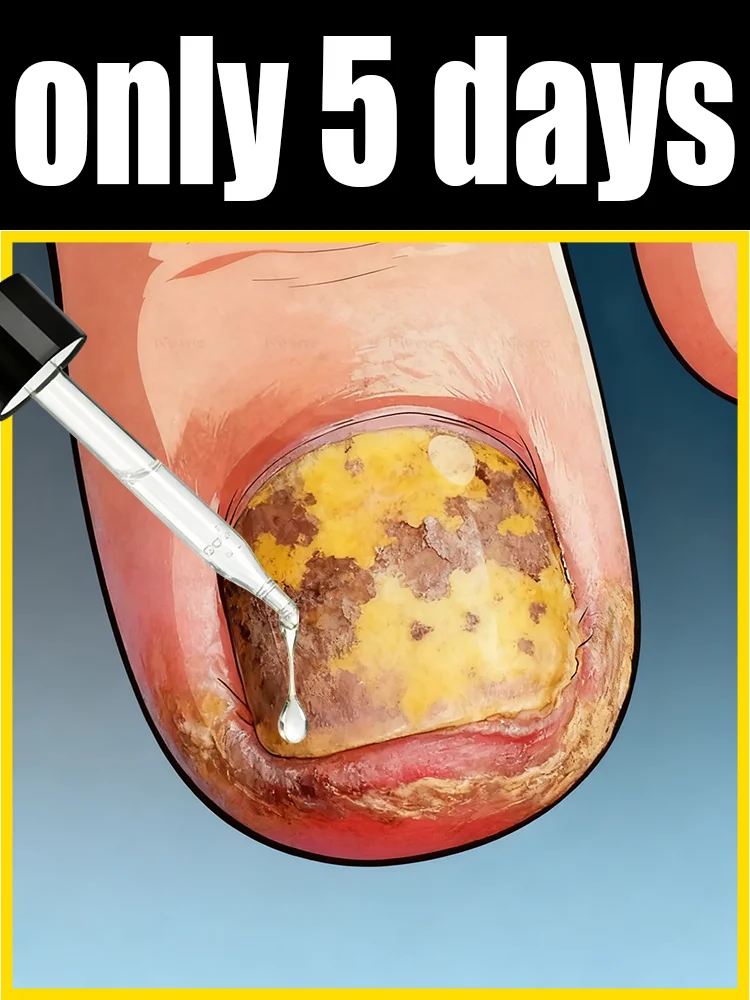 

Say goodbye to uneven, yellow nails and cultivate smooth, shiny ones