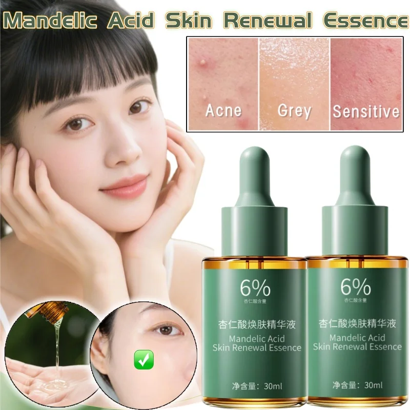 

Almond Acid Rejuvenating Serum 30g Effectively Brightens Skin Tone Improves Blackheads Shrinks Pores Repairs Fruit Acid Serum