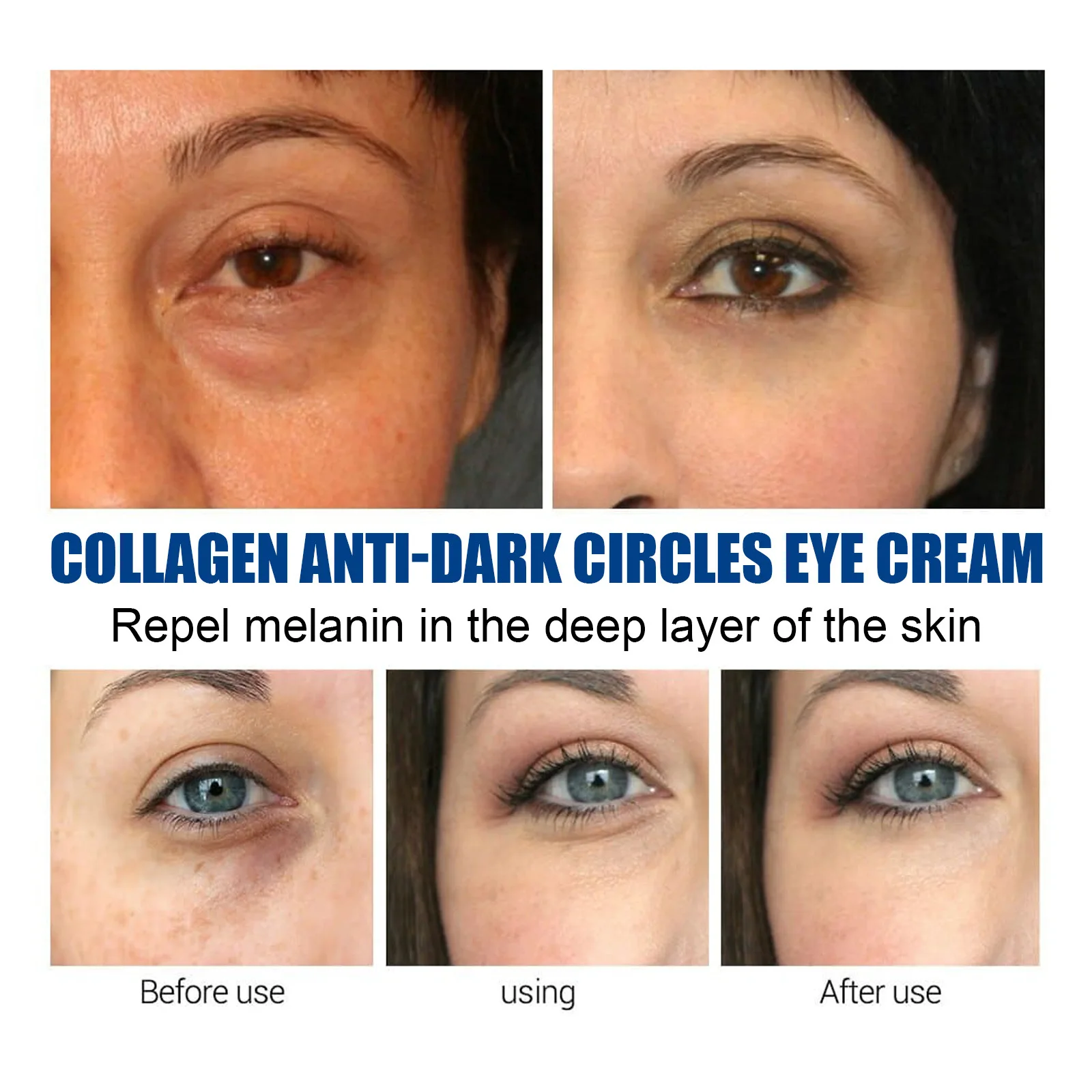 Anti Dark Circle Eye Cream Remove Puffiness Particle Removal Improve Dullness Fade Lines Bag Moist Dry Hydrating Tighten Sagging