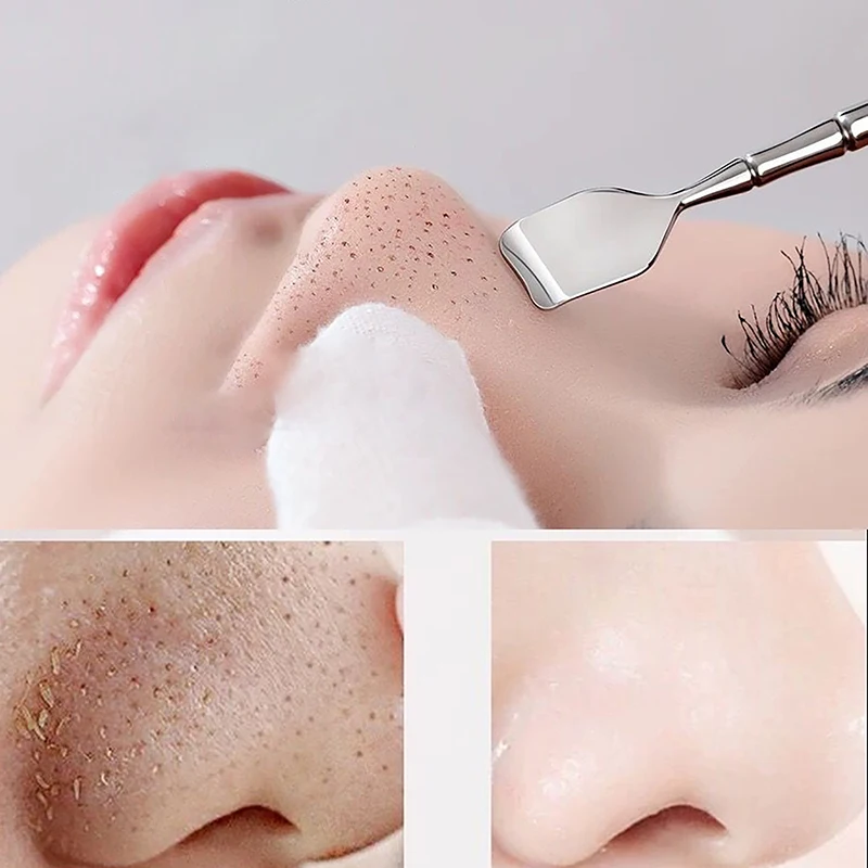 Pimple Popper Tool Blackhead Remover Acne Needle Removing Treatment Whitehead Popping Zit Nose Face Blemish Extractor Tools