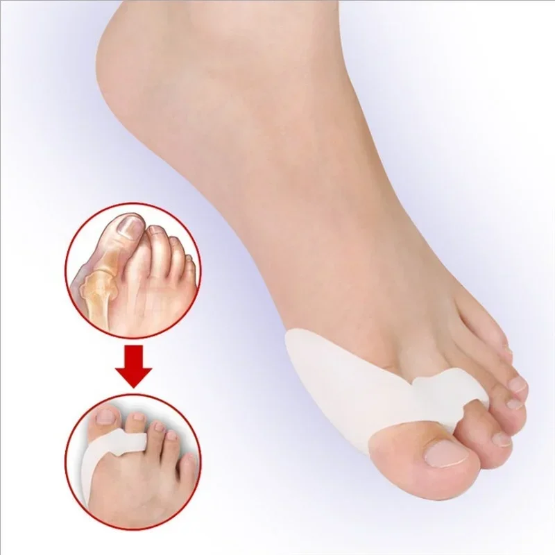 Doigts de pied en gel de silicone, protecteur de pouce Valgus, ajusteur d'oignon, garde Hallux Valgus, soins des pieds, séparateur Parker à deux trous, 1 paire