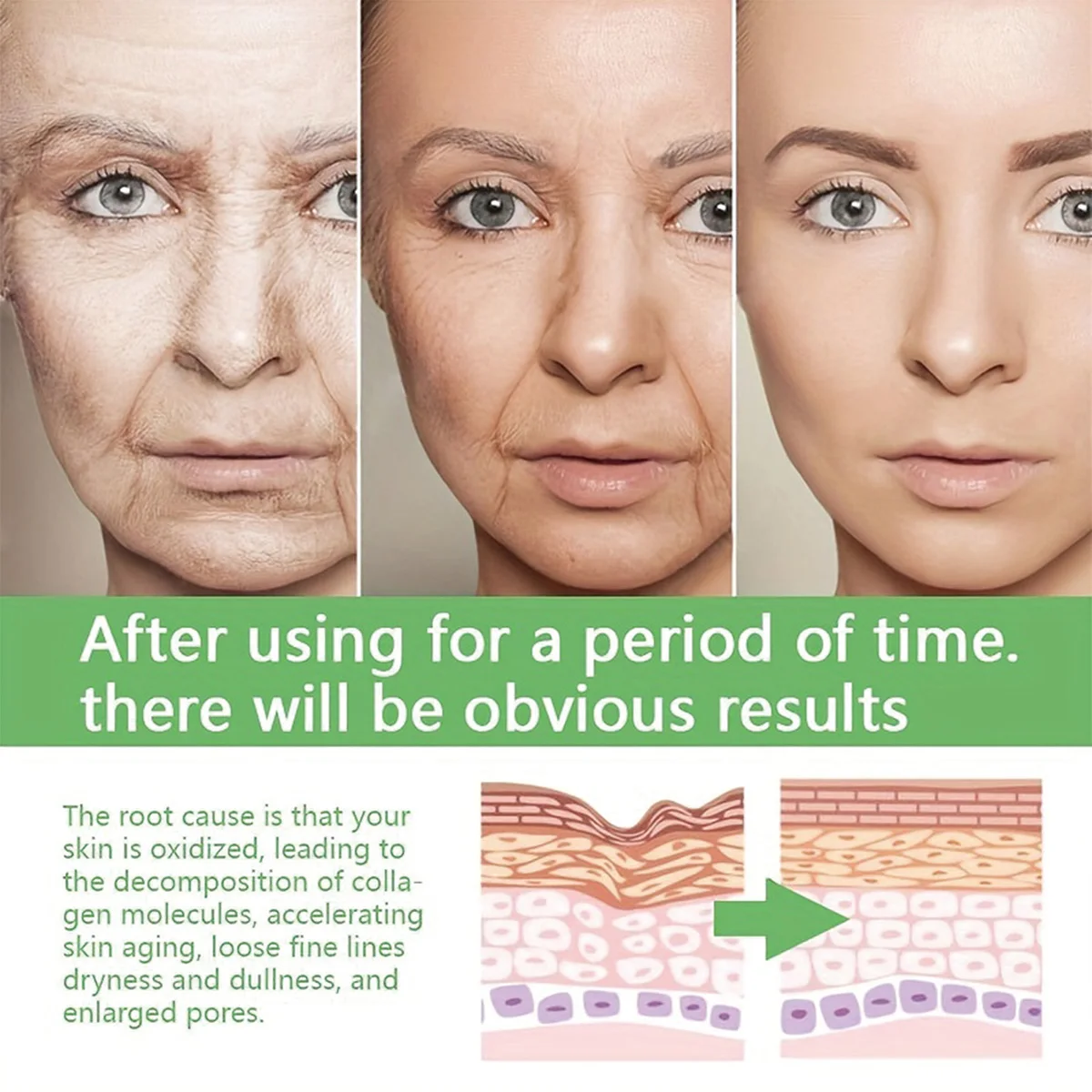 TRSTAY Collagen Essence Facial Activator ต่อต้านริ้วรอยผิวกระชับและ Smoothing Beauty Care สําหรับแม่และเด็ก