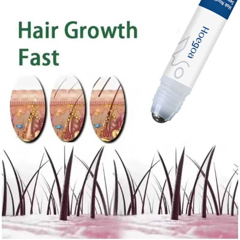 

2026 Hair Growth Oil for Man Woman Nourish Scalp Activate Follicle Stimulator Anti Hair Loss Treatment Hair Regrowth Roller