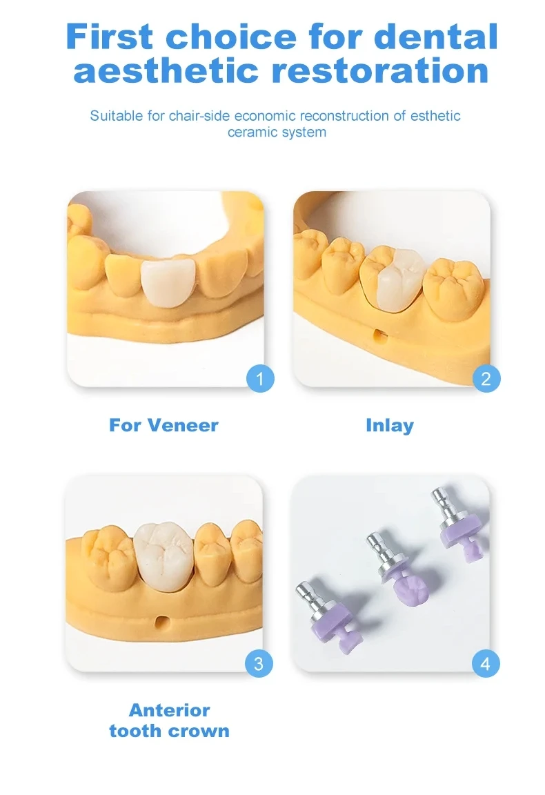 Рисунок 6 - Стоматологические стеклянные керамические
