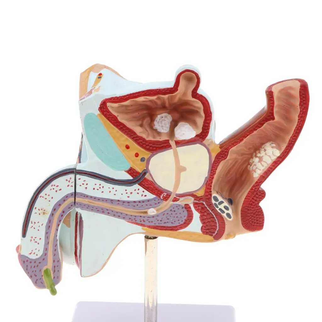 Medical Male Reproduction Diseased Anatomical Human Penis Reproductive Organs Anatomy Model Urinary System Pathlology Models