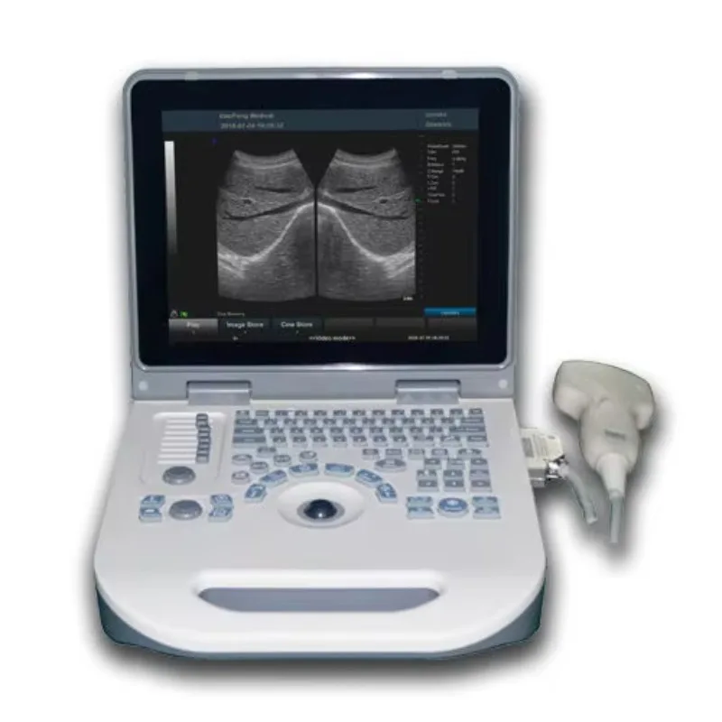 Vet Ultrasound Portable Veterinary Ultrasound Machine Price