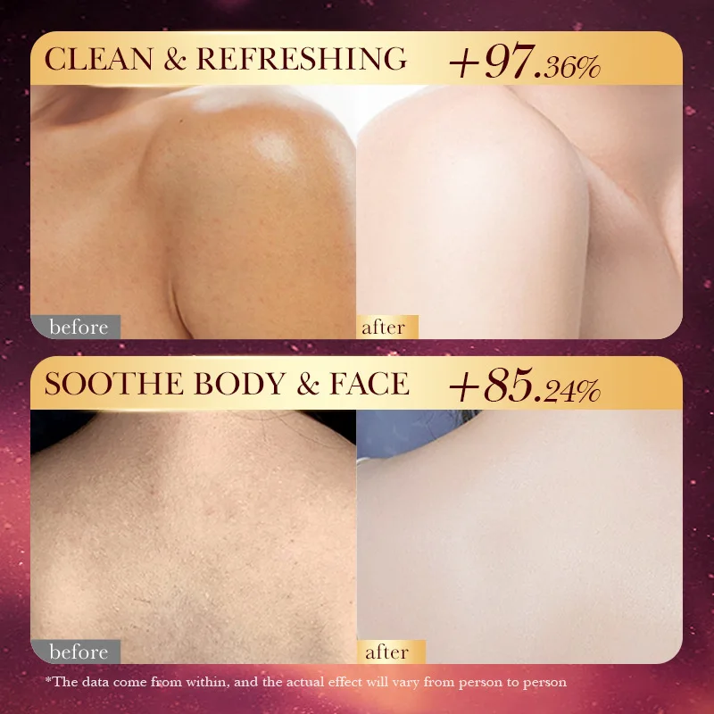 100g เพชรผลไม้หอม Handmade สบู่บาร์ธรรมชาติสบู่น้ํามันหอมระเหยสําหรับใบหน้า,Body,Whitening,กระจ่างใส,หดรูขุมขน