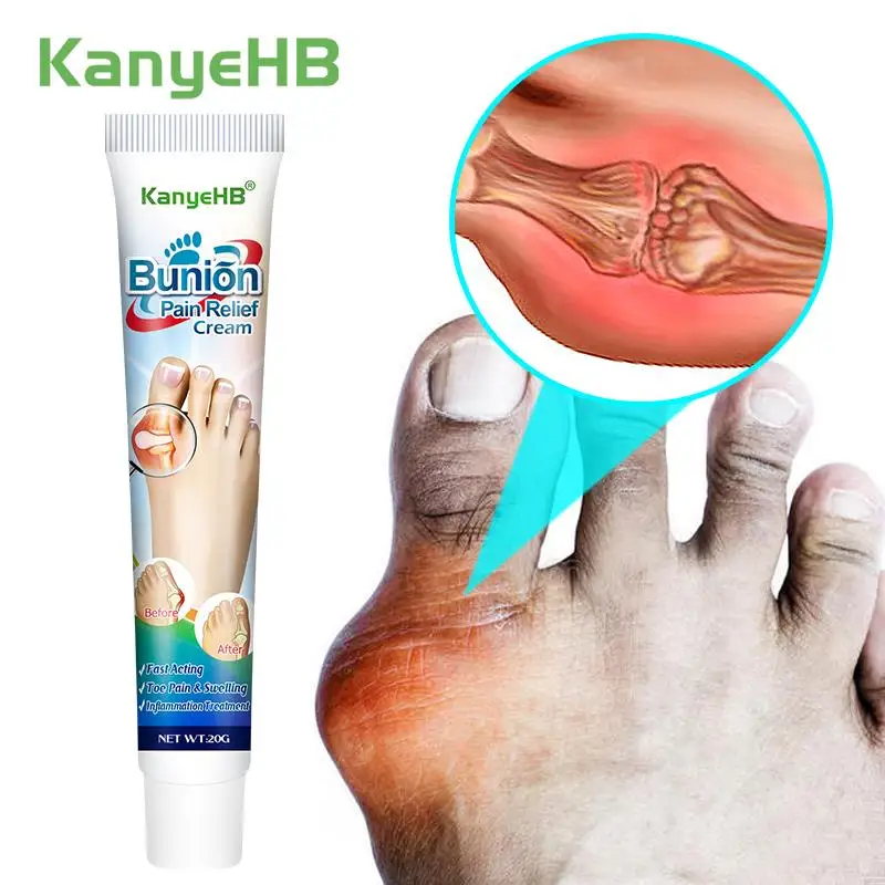 

1Pcs Foot Gout Herbal Cream Thumb Corrector Finger Hallux Treatment Toe Bunion Pain Relieve Medical Ointment Health Care G019