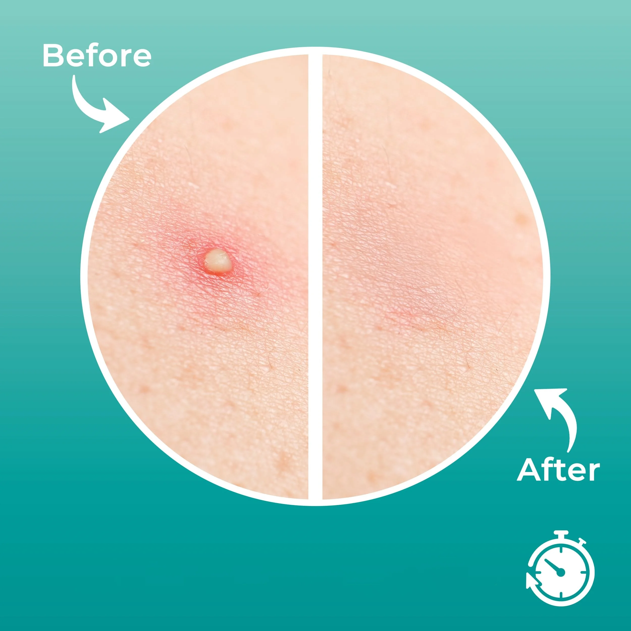 شرائط الأنف الغروانية المائية (10 قطع) - خالية من العطور ولطيفة - تطهير عميق للرؤوس السوداء وتفتح المسام، مناسبة لجميع أنواع البشرة #3