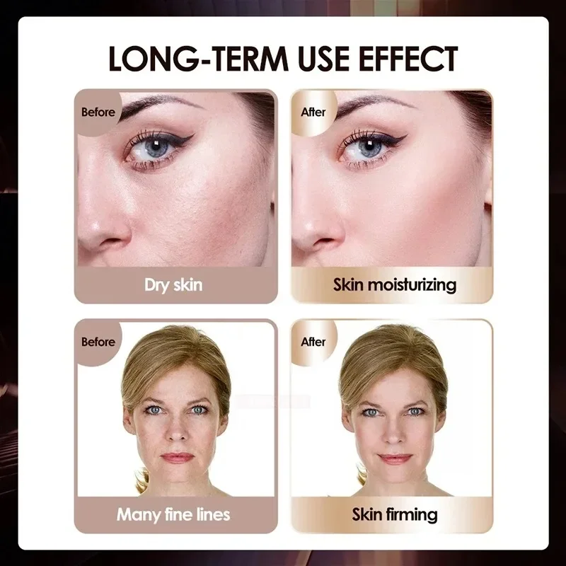 เครื่องมินิ HIFU 4 in 1 รุ่นใหม่ล่าสุด เจเนอเรชั่นที่ 3 พร้อม EMS Pulse Warm Up สำหรับนวดหน้าและผิวกาย อุปกรณ์เสริมความงามด้วยคลื่นอัลตราซาวด์