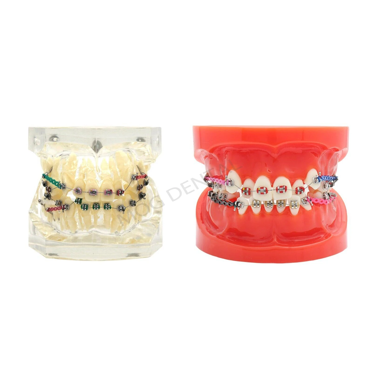 Dental Model with Orthodontic Bracket Dental Teaching Model For Dentist Treatment Demo Training Studying