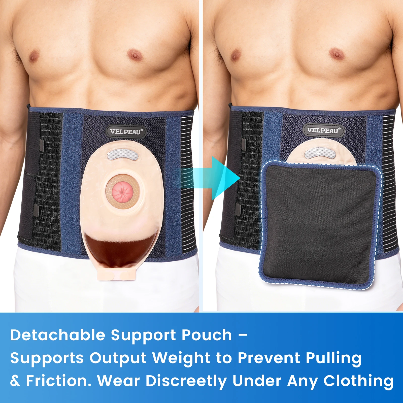 

VELPEAU Ostomy Stoma Support Belt, Ostomy Abdominal Waist Belt, Colostomy Bags Belt, Unisex Ostomy Hernia Support Belt
