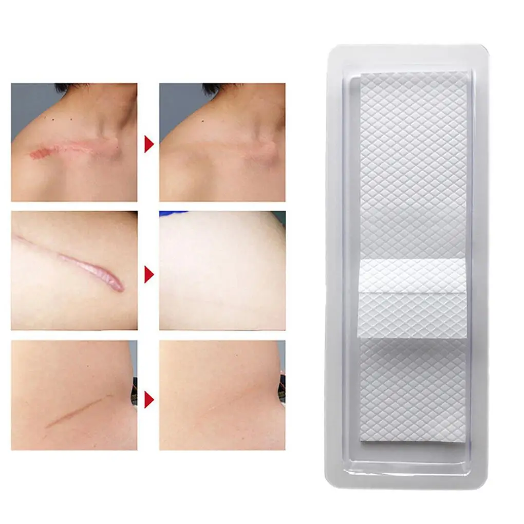 Silicone Removal Scar Patch Reusable Acne Self-adhesive Sticker Breathable Invisible Skin Care Tape Healing Treatment