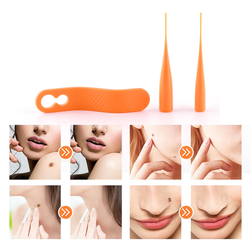 2 In 1 ชุดกําจัดผิว MINI Mole Wart เครื่องมือผิว Facial Mole Wart Remover ทําความสะอาดผ้าฝ้าย Swab Facial Care เครื่องมือแบบพกพา