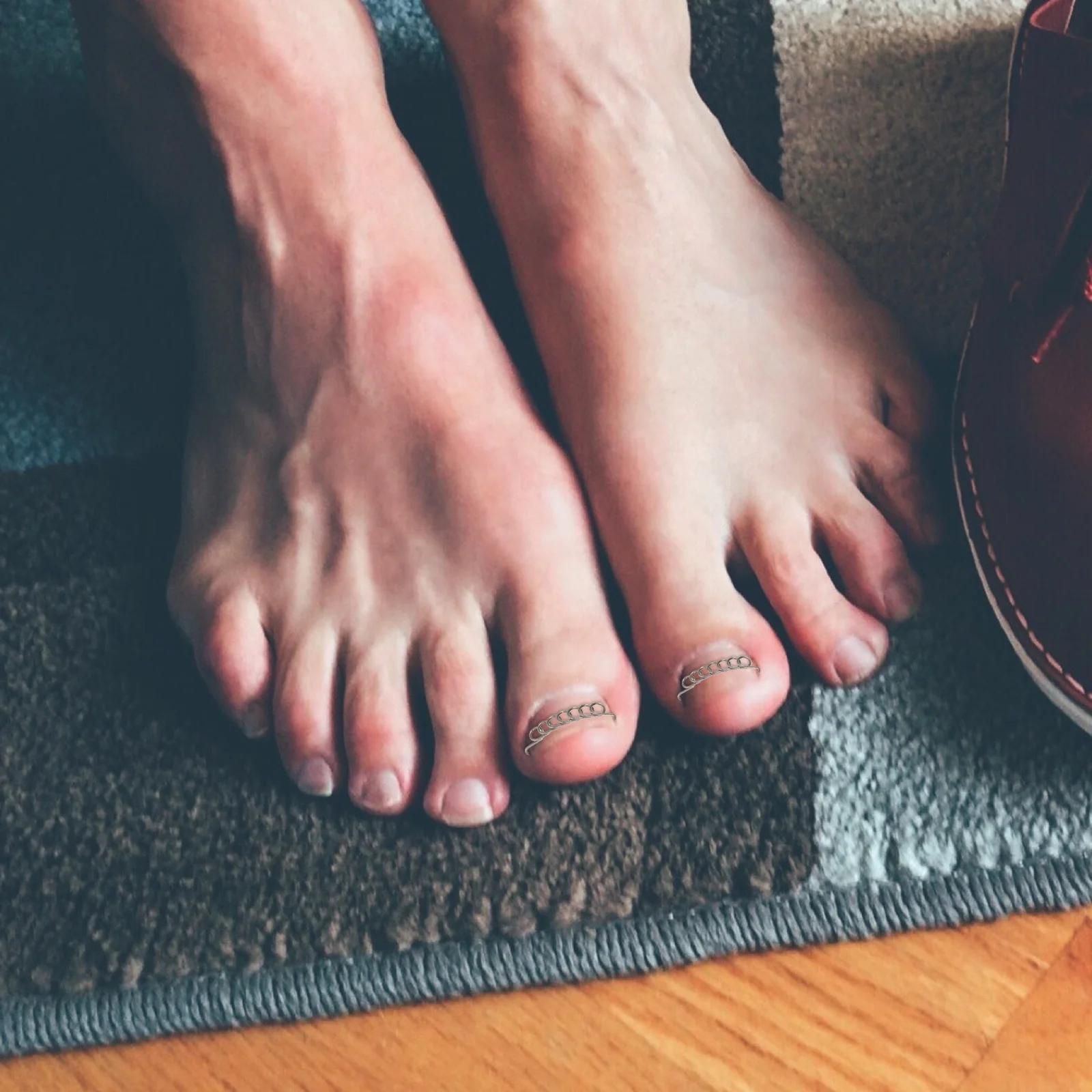 

12pcs Stainless Steel Toenail Corrector Reusable Nail Correction Wire For Ingrown Toenail Relief Compact Foot Care